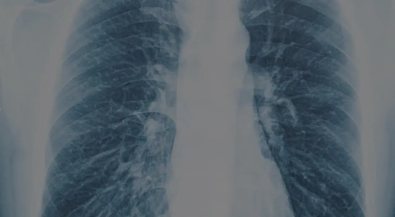 The Thorax by Valéria A Ferreira